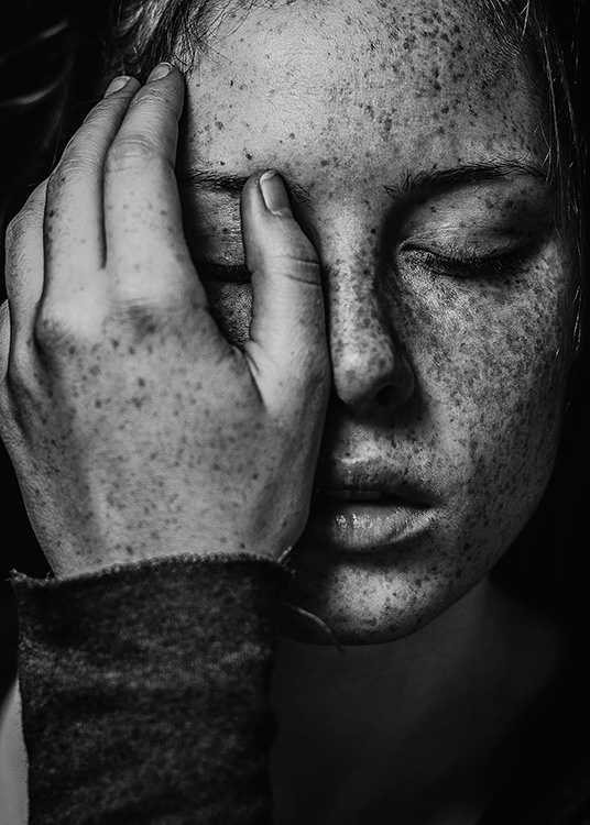 Girl With Freckles Poster / Black & white at Desenio AB (12015)